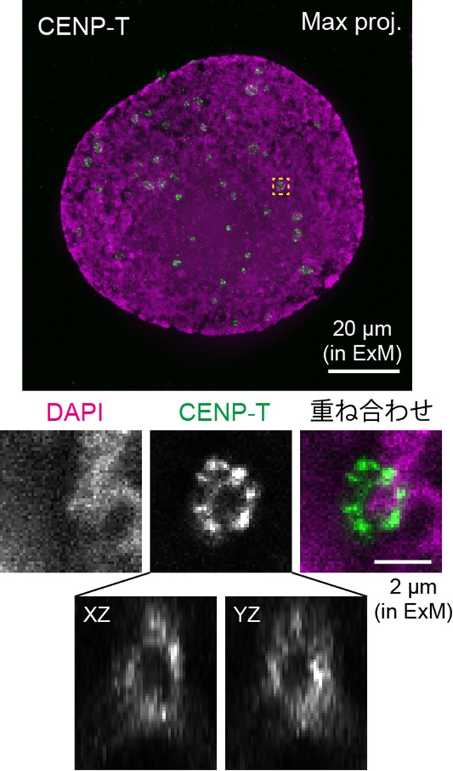 図3 CENP-Tで染色されたセントロメアの超解像イメージング